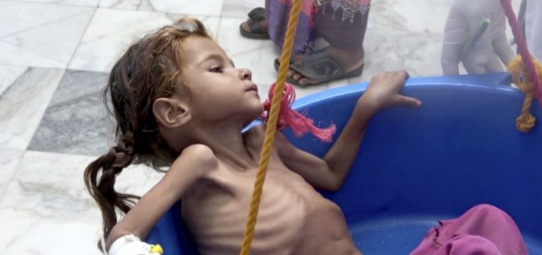 Yemen’de İnsani Yardımlar Bazı Bölgelerde Kısmen Askıya Alındı