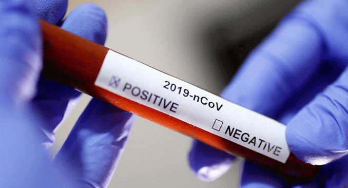 Çekya’da ilk yeni koronavirüs vakaları tespit edildi