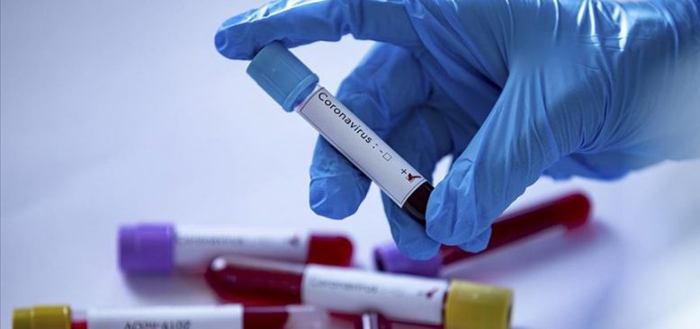 Alman kulübü Köln'de 3 kişide koronavirüs tespit edildi