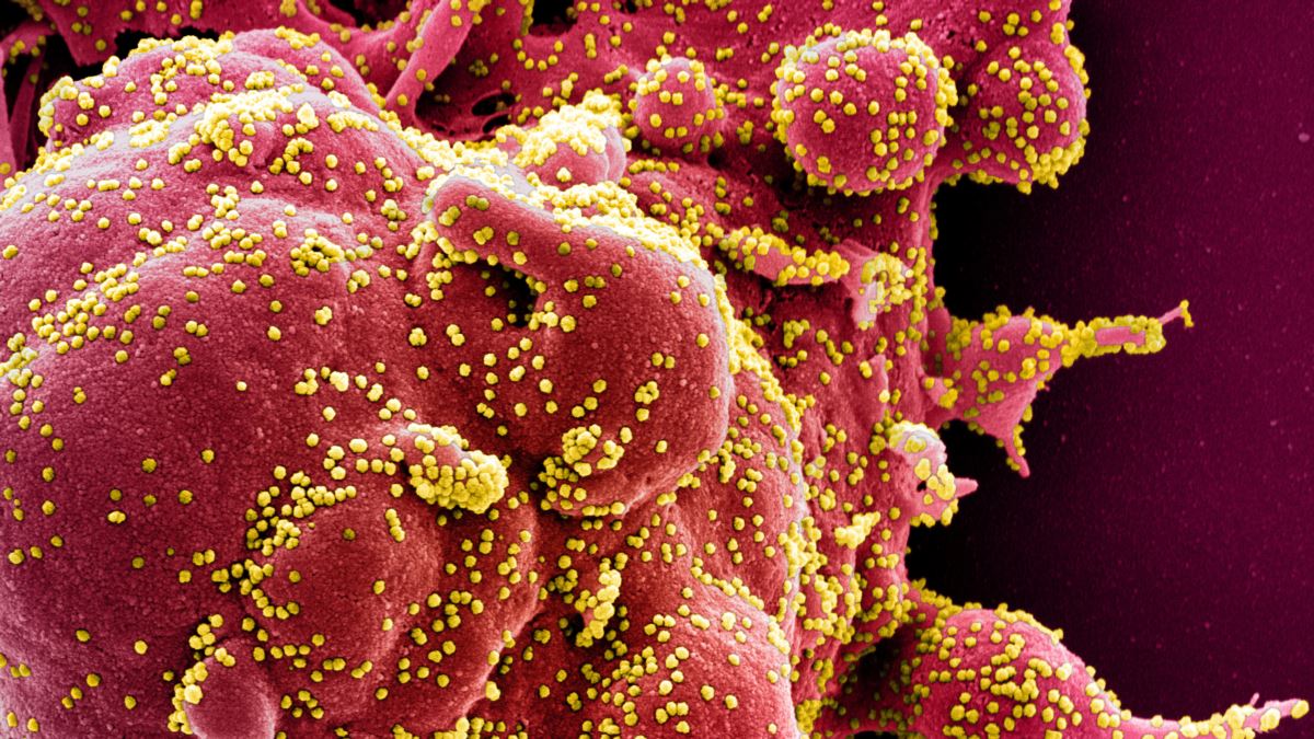 T Hücreleri Corona Virüsüne Yanıt Olabilir mi?