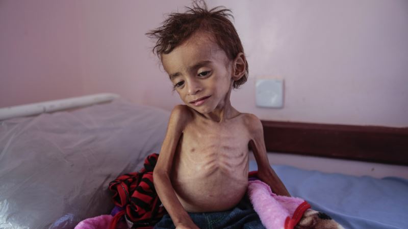 BM: “Yemen’de Halk Açlıktan Ölüyor”