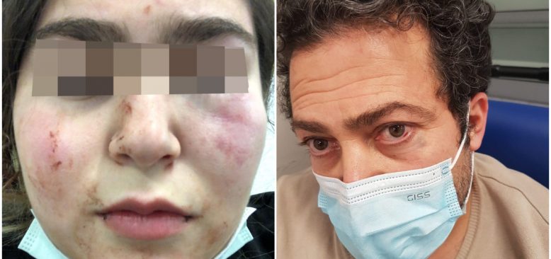 Almanya'da polis 17 yaşındaki Türk kızını ve babasını hastanelik etti