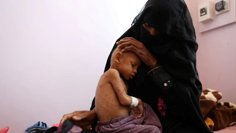“Yemenliler İçin Kıtlığa Artık Sadece Bir Adım Kaldı”
