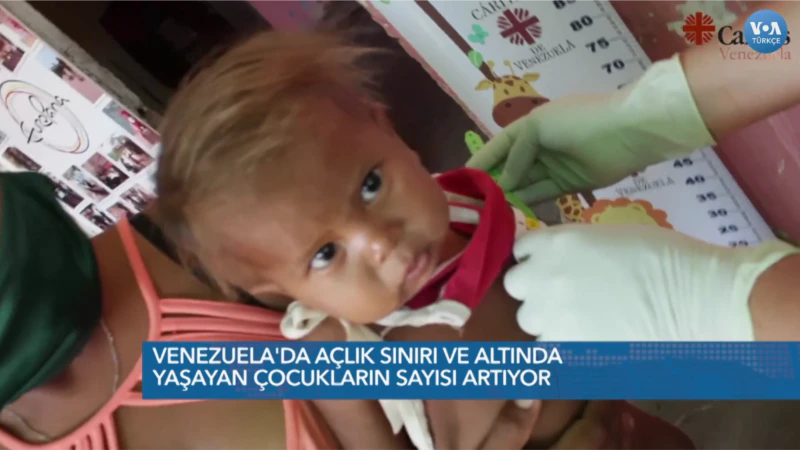Venezuela’da 1 Milyondan Fazla Çocuğun Gıdaya Erişimi Kısıtlı