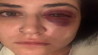 Kadın sokak ortasında dövüldü