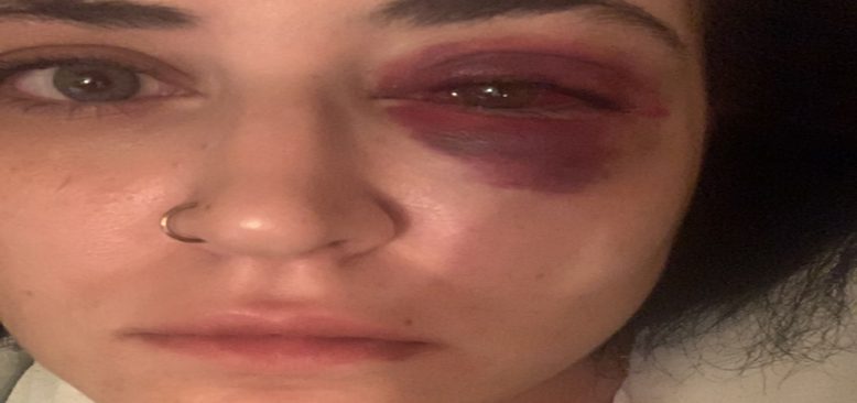 Kadın sokak ortasında dövüldü