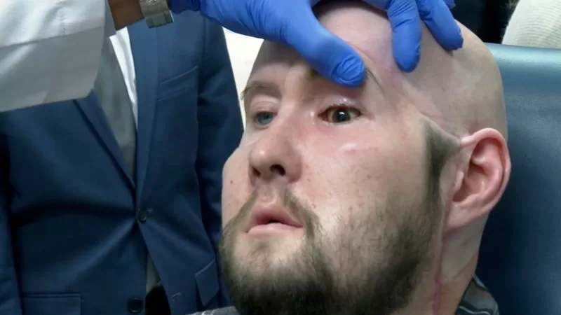 New York’ta dünyanın ilk göz nakli ameliyatı yapıldı