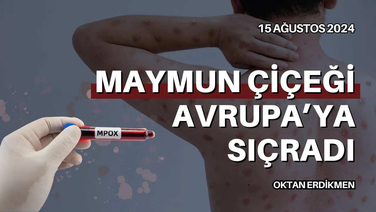 Maymun çiçeği virüsü Avrupa’ya sıçradı