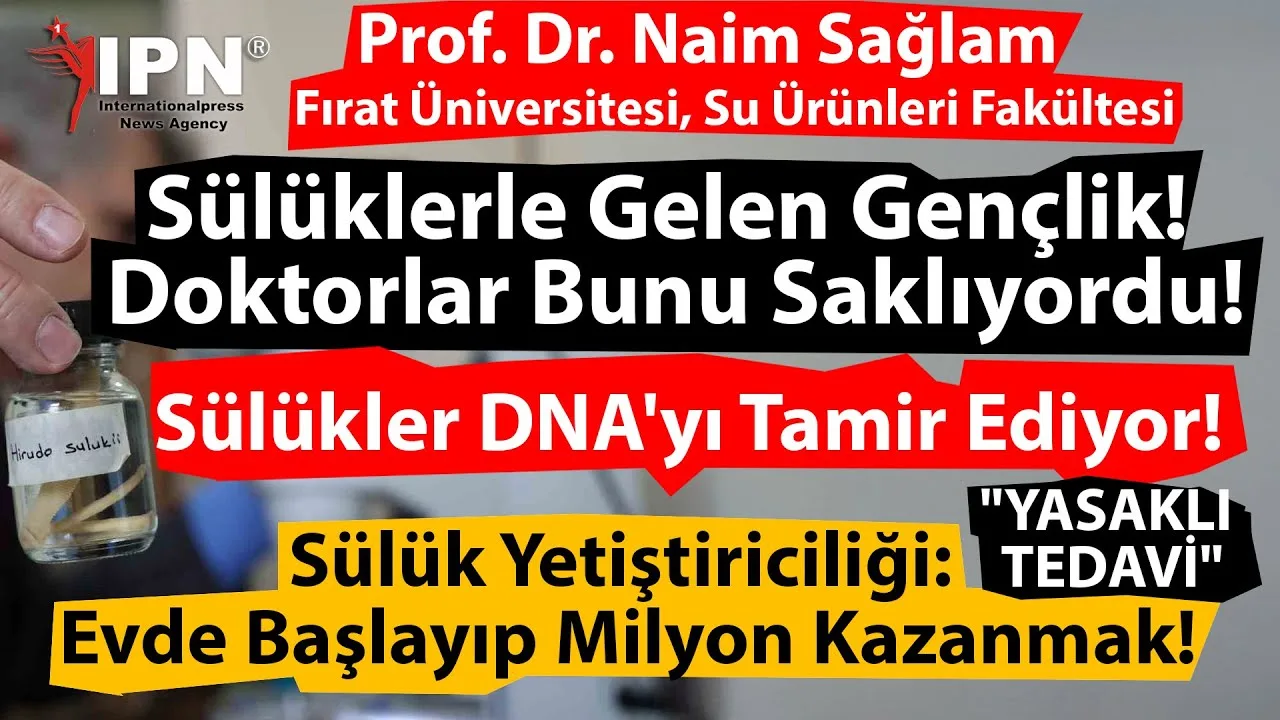 Bir Sülük 18.5$ Bu İşte Milyon Kazananlar Var