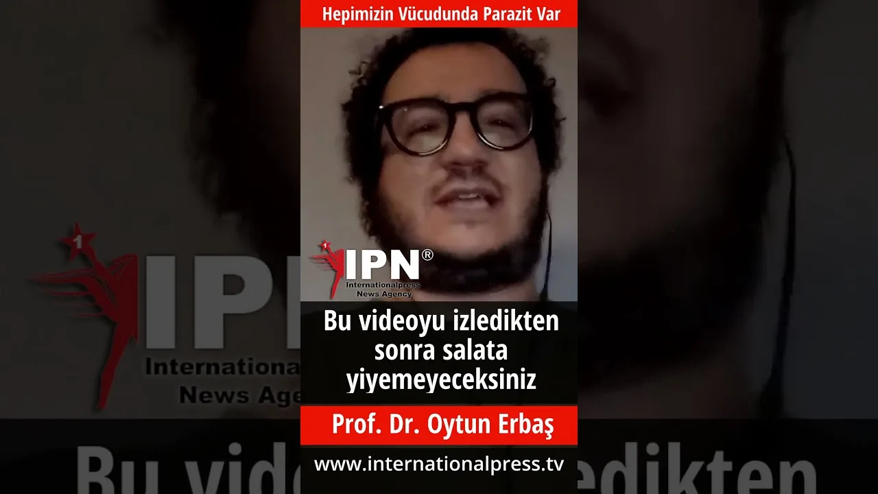 Hepimizin Vücudunda Parazit Var