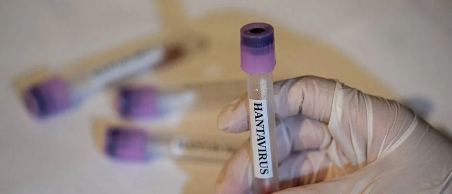 EMA: Hantavirüs için onaylı aşı veya tedavi bulunmuyor